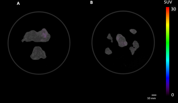 Specimen PET-CT Imaging - lymph nodes