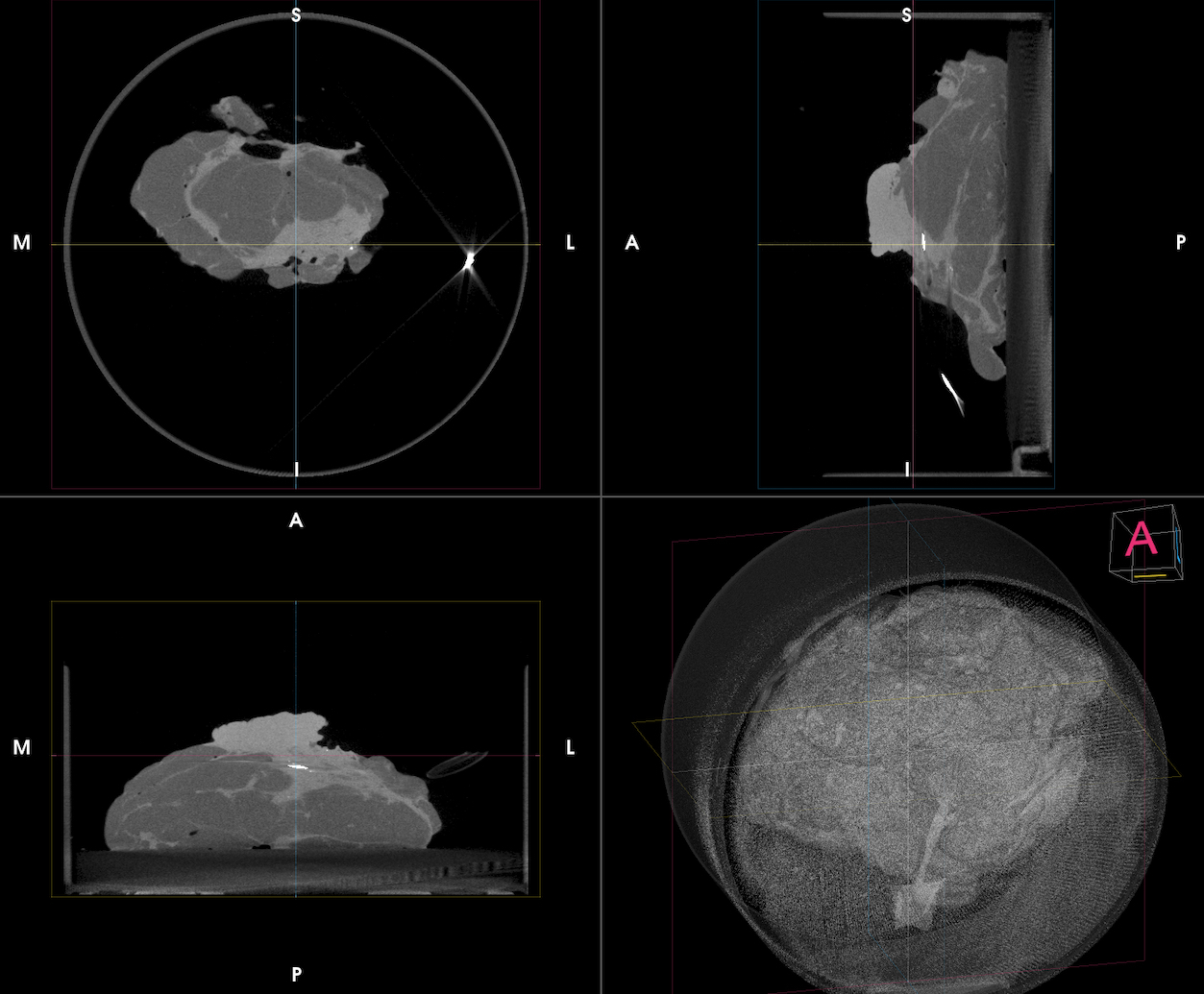 PET-CT specimen images